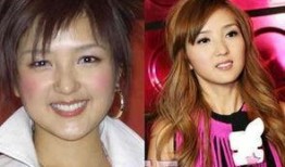 最近明星整容爆料视频,明星整容真相大曝光！